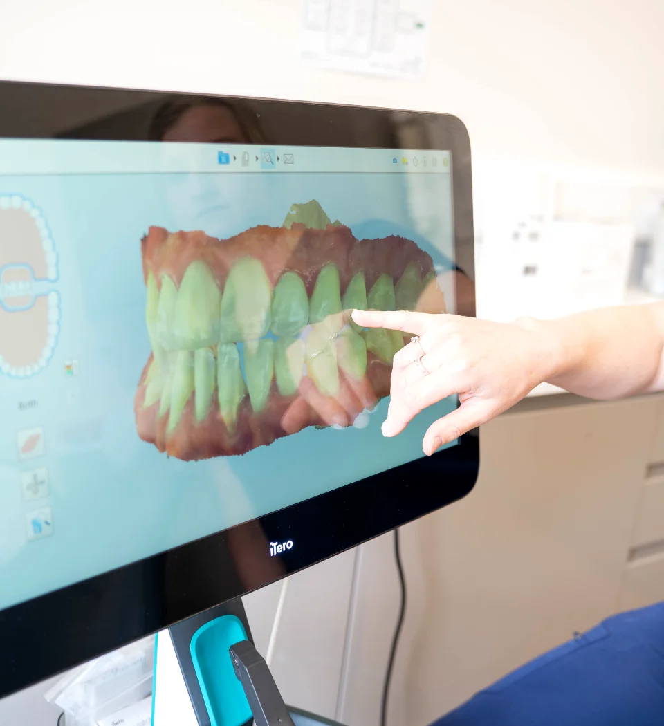 get invisalign torquay